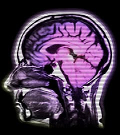 Gaybrain