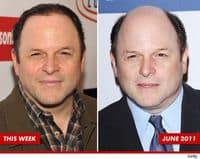 Jason-alexander-has-hair-now-17286-1316893804-3