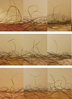 Leghair