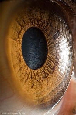 Eye