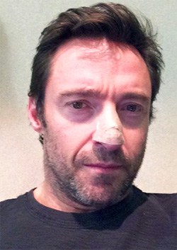 Jackman