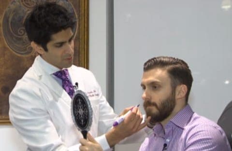 Beard_1