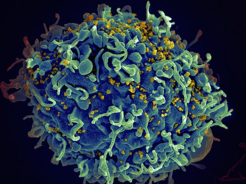 HIV and T-Cell