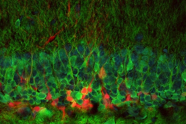 Neurons