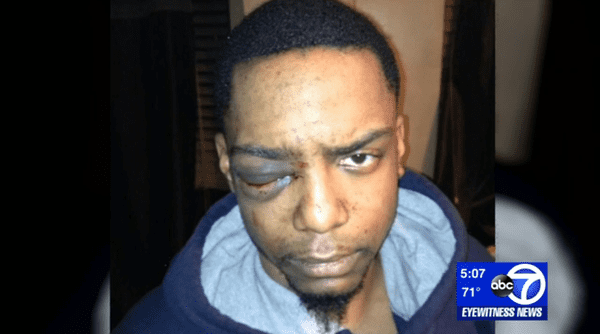 taj patterson assaulted by Mayer Herskovic