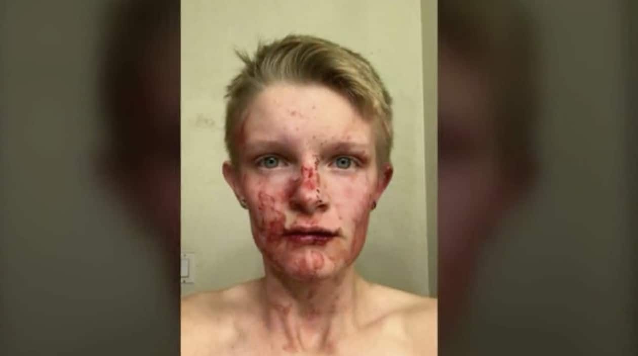 gay attack santa fe