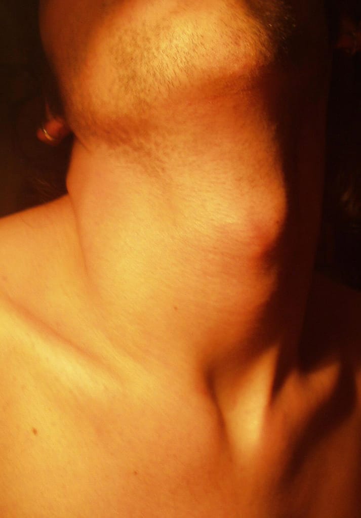 male neck