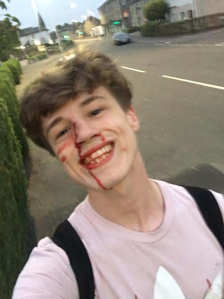 bloody selfie