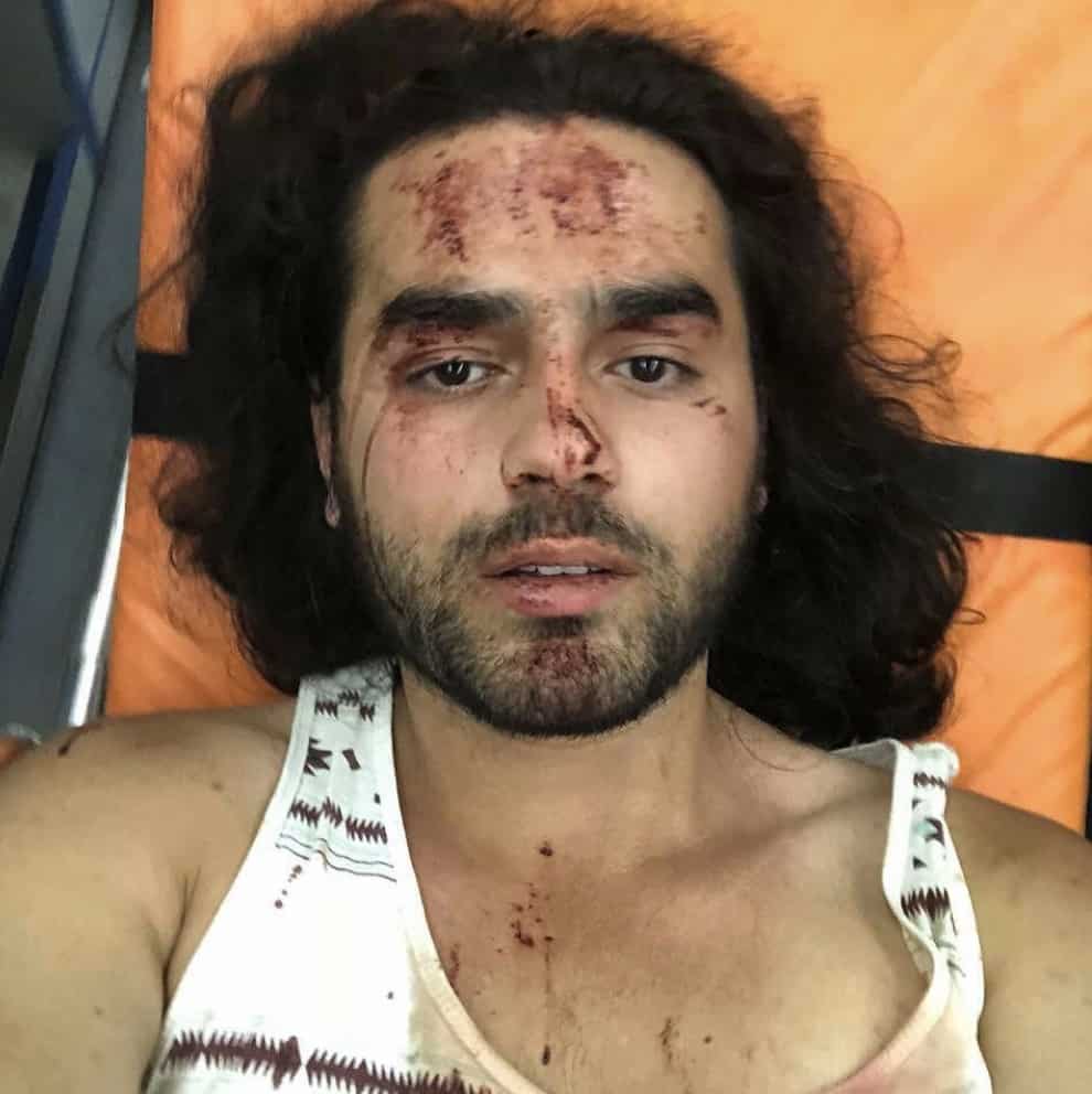 Armenia attack