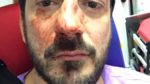 Melanie Paris homophobic attack