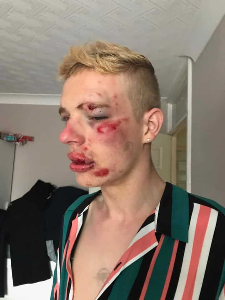 Ryan Williams homophobic attack