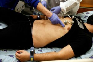 Almost a third of people report lingering symptom 6-12 months after COVID-19 -study 14 498346 origin 1