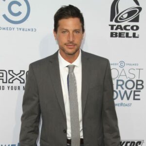 Simon Rex wants prosthetic to go to a museum 4 502041 origin 1