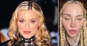 Inside Madonna's Bizarre Face Transformation — Plastic Surgeons Weigh In 40 505861 origin 1