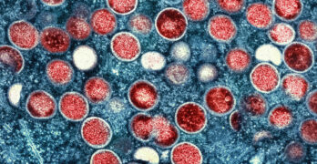 monkeypox symptoms transmission