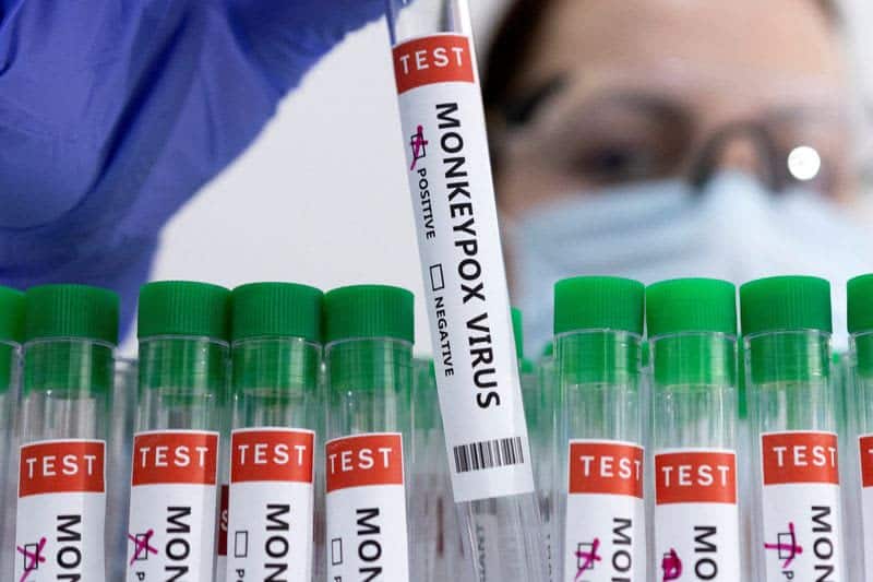 Health Agency Confirms Community Spread Of Monkeypox In England 1 582958 origin 1