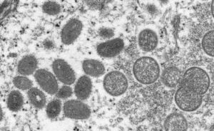 New York stresses monkeypox vaccine 'urgency' as cases rise 4 595405 origin 1