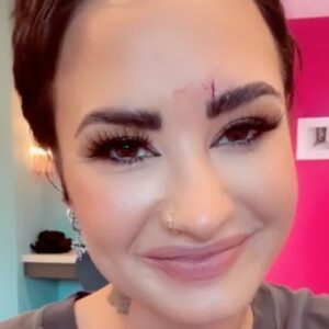 Demi Lovato suffers bloody face injury after hitting their head on crystal 8 596001 origin 1