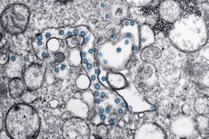 Study: Covid boosters protect against 'severe disease' from Omicron 32 602115 origin 1