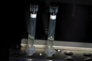 Spain reports second monkeypox-related death in Europe 4 629147 origin 1