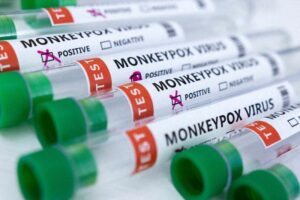 Biden to name FEMA, CDC officials to lead U.S. monkeypox response -AP 6 633948 origin 1
