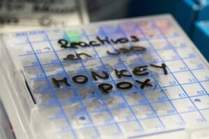 Are there monkeypox myths? A doctor breaks down disease fact and fiction 16 634383 origin 1