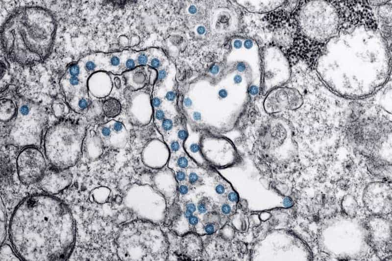 Omicron seen as a milder coronavirus, but scientists aren't so sure 11 636688 origin 1