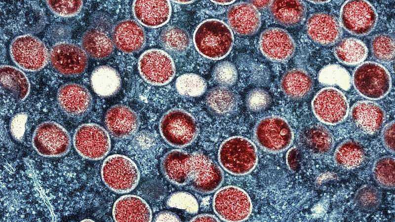 Twitter failed to tackle LGBTQ monkeypox hate speech, says study 33 638185 origin 1