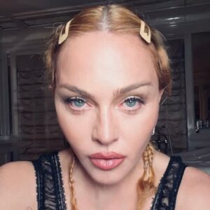 She’s back! Madonna breaks silence after health crisis to reassure fans she is on ‘road to recovery’ 19 685476 origin 1