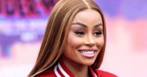Blac Chyna Stuns in Photoshoot After Removing Body Implants and Dissolving Filler 12 686914 origin 1